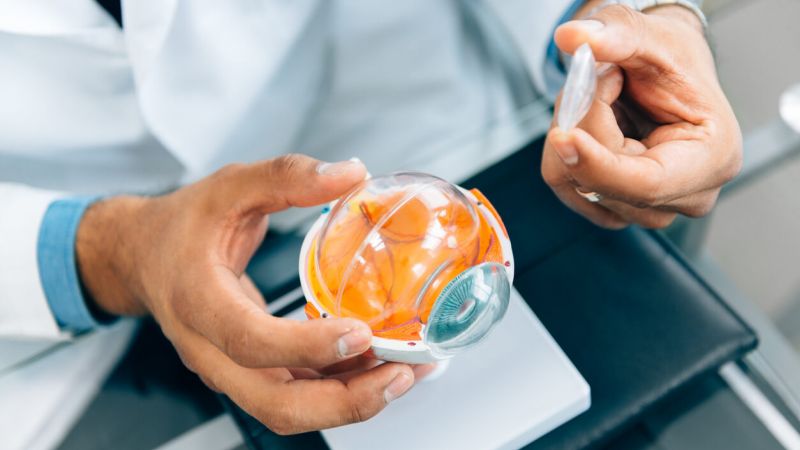 Photorefractive Keratectomy