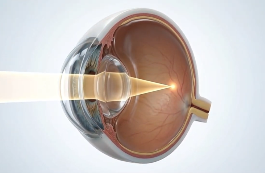 Cornea anatomy diagram