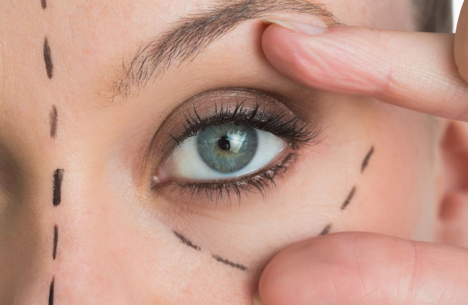 preparing for eye surgery