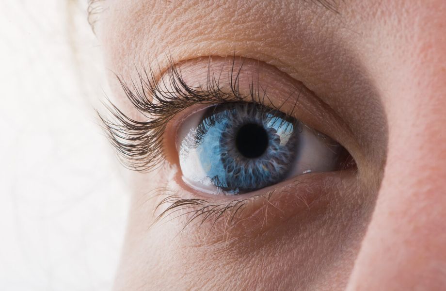 Cataracts