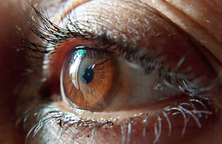 an eye to represent glaucoma and cataracts