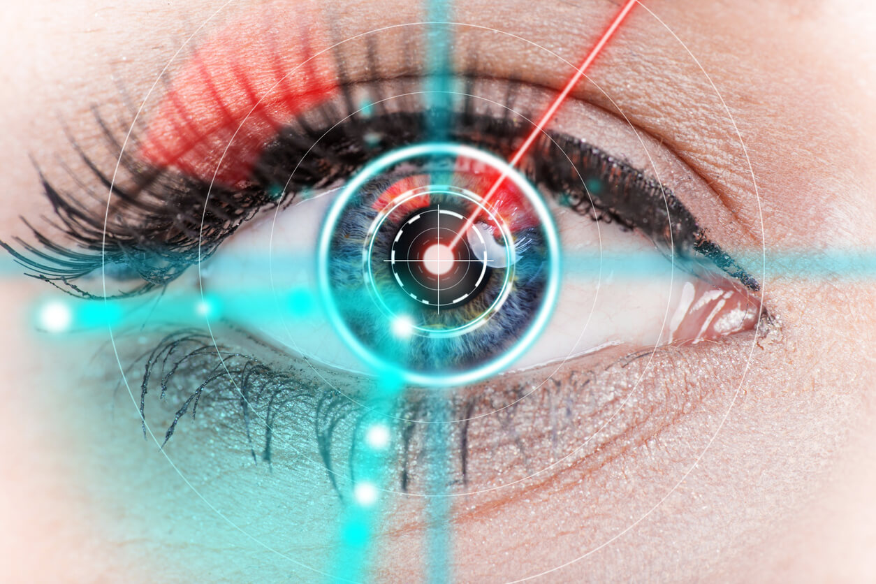 Refractive Surgery