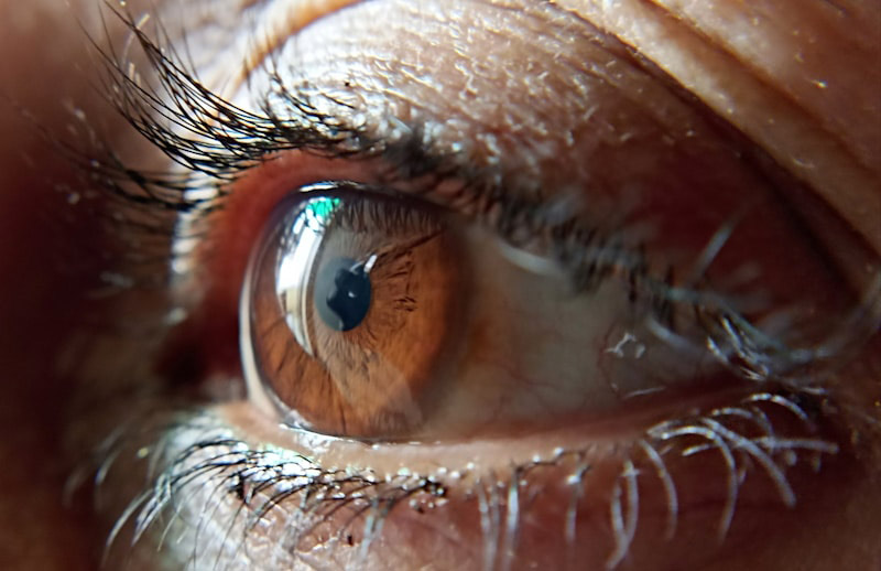 an eye to represent glaucoma and cataracts