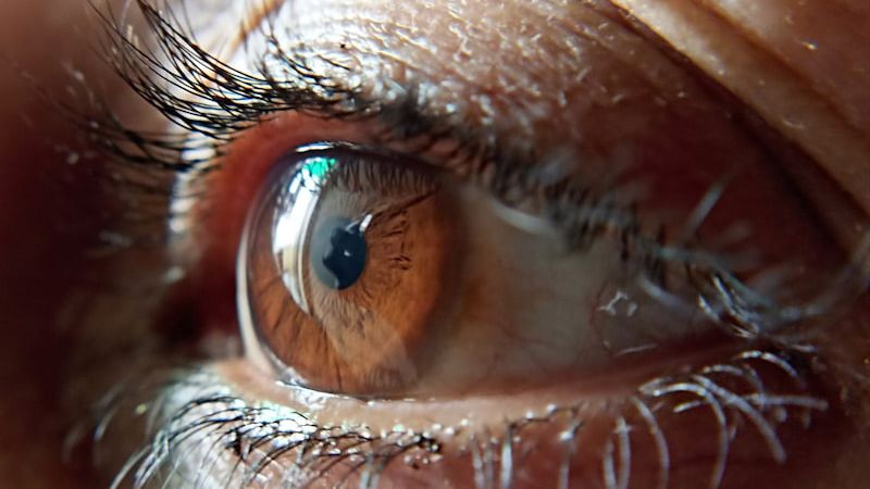 an eye to represent glaucoma and cataracts