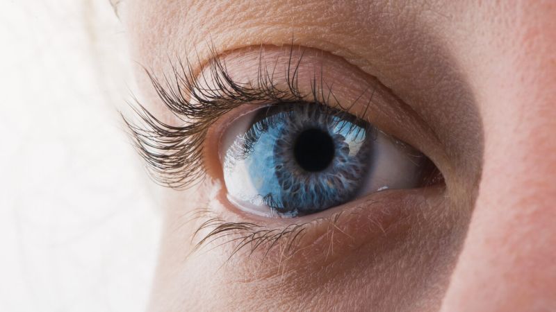 Cataracts