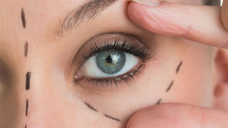 preparing for eye surgery