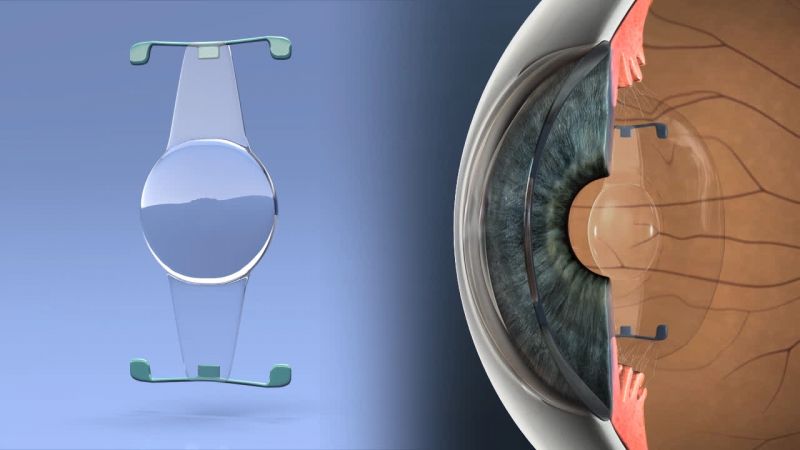 image of a lens for education