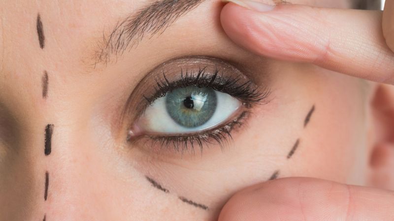 preparing for eye surgery