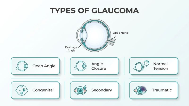 Types of Glaucoma: