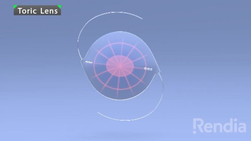 image of a toric lense