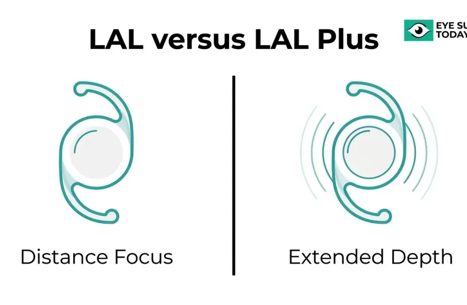 Comparison illustration of LAL versus LAL Plus lenses showing distance focus and extended depth of focus technology
