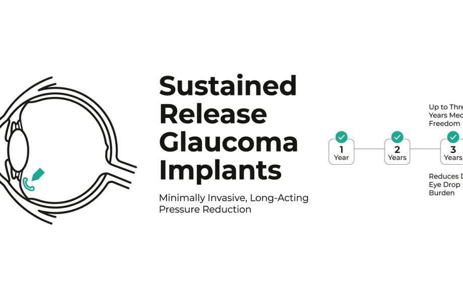iDose and Sustained Release Implants for Glaucoma