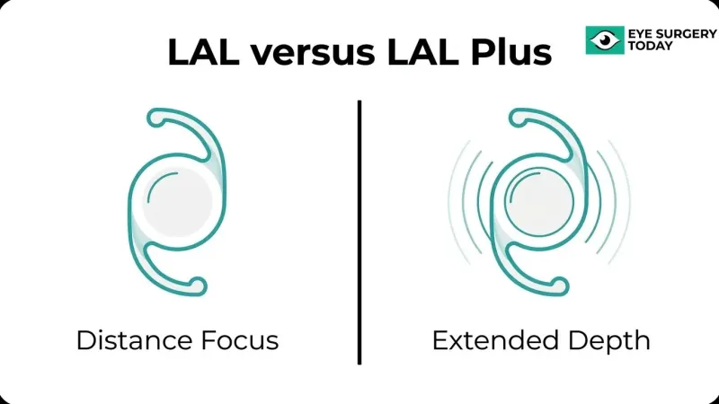 Comparison illustration of LAL versus LAL Plus lenses showing distance focus and extended depth of focus technology